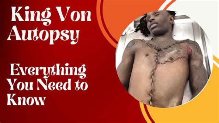 Unraveling the Mystery of Von Autopsy